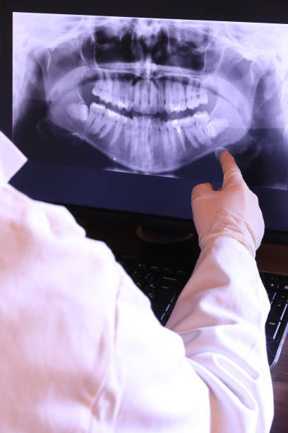 Best Emergency Root Canal Therapy in Tucson Estates, AZ